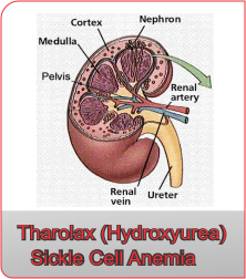Sickle Cell Drug, Hydroxyurea, Shown